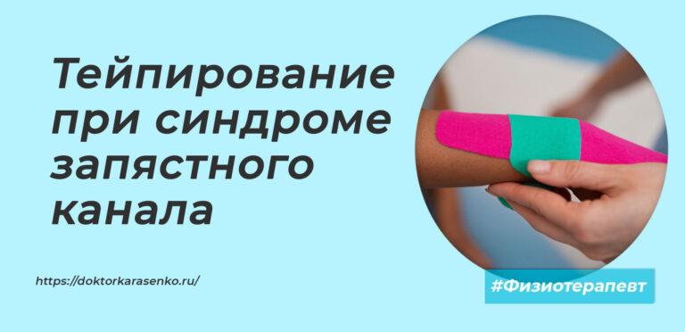 Тейпирование при синдроме запястного канала