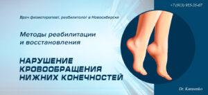 Нарушения кровообращения нижних конечностей