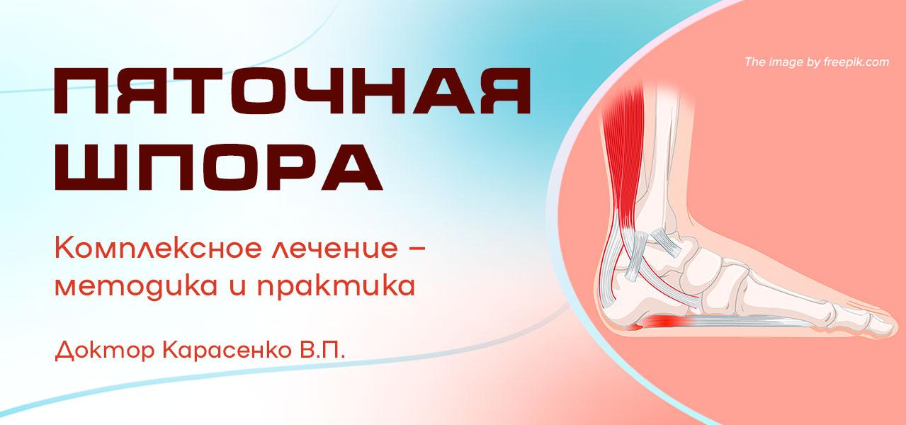 комплексное лечение пяточной шпоры